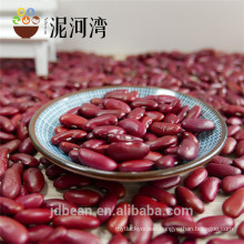2017 select New Crop Britain Dard Red Kidney Beans for food